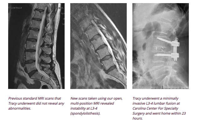 carolina neurosurgery and spine